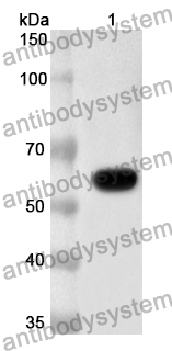 Anti-Nipah virus/HeV G protein/Glycoprotein G Polyclonal Antibody
