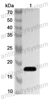 Anti-EBV/HHV4 EBNA1/BKRF1 Polyclonal Antibody