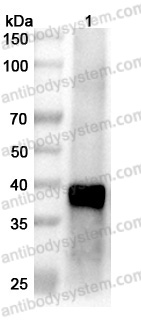 Anti-Langya virus/LayV M/Matrix protein Polyclonal Antibody