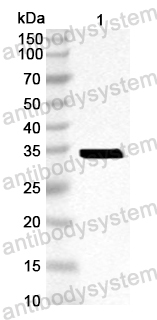 Anti-CA16 VP1/P1D Polyclonal Antibody