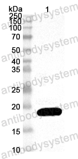 Anti-EV71 P2A/Protease 2A Polyclonal Antibody