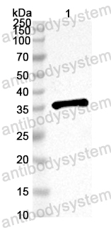 Anti-EV71 VP4/P1A Polyclonal Antibody