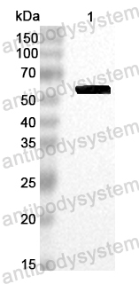 Anti-EV71 VP1/P1D Polyclonal Antibody