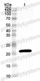 Anti-EV71 P3C/Protease 3C Polyclonal Antibody