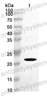 Anti-EV71 P3C/Protease 3C Polyclonal Antibody