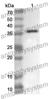 Anti-MARV VP40/Marburg VP40 Polyclonal Antibody