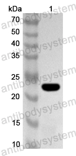 Anti-RD114 retrovirus env/Envelope glycoprotein Polyclonal Antibody