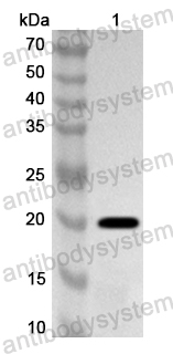 Anti-ASFV B438L/p49 Polyclonal Antibody