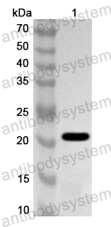 Anti-CCHFV GP/Envelope glycoprotein Polyclonal Antibody