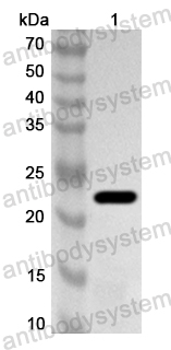 Anti-MuV HN/Hemagglutinin-neuraminidase Polyclonal Antibody