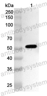 Anti-BCCV Gn/Glycoprotein N Polyclonal Antibody