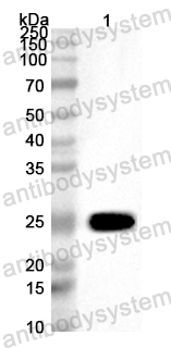 Anti-ASFV UBC/pI215L Polyclonal Antibody