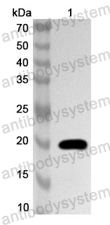 Anti-HAdV-3 Packaging protein 3/L1 Polyclonal Antibody