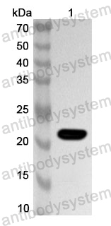 Anti-HAdV-5 Fiber protein/L5 Polyclonal Antibody