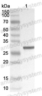 Western Blot for Anti-SFTSV NP/Nucleoprotein Polyclonal Antibody ?>