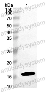 Anti-HCoV-OC43 M/Membrane protein Polyclonal Antibody