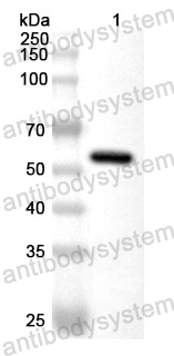 Anti-IBV S1/Spike glycoprotein 1 Polyclonal Antibody