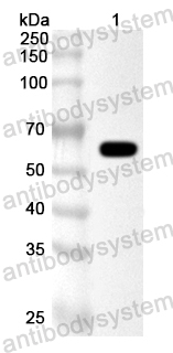 Anti-Corynephage omega DT/Diphtheria toxin Polyclonal Antibody
