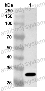 Anti-Brucella suis Response regulator transcription factor Polyclonal Antibody