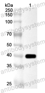 Anti-Bacillus cereus gajA Polyclonal Antibody