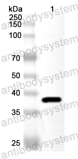 Anti-Brucella suis omp19 Polyclonal Antibody