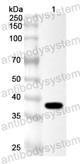 Anti-Pseudomonas CopC Polyclonal Antibody