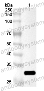 Anti-Clostridium perfringens cpb2/Beta2-toxin Polyclonal Antibody
