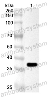Anti-Clostridium perfringens cpb/Beta-toxin Polyclonal Antibody