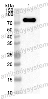 Anti-Streptococcus pneumoniae pbpX Polyclonal Antibody