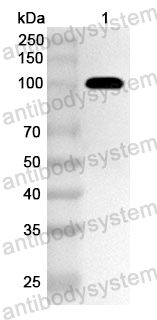 Anti-Streptococcus suis ssnA Polyclonal Antibody