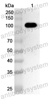 Anti-Streptococcus suis ApuA Polyclonal Antibody