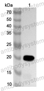 Anti-Streptococcus pyogenes sortase Polyclonal Antibody