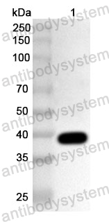 Anti-Streptococcus pyogenes arp4/IgA receptor Polyclonal Antibody