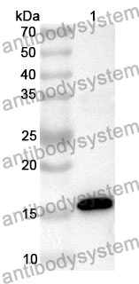 Anti-Delta(12)-acyl-lipid-desaturase-like Polyclonal Antibody