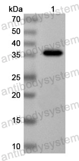 Anti-Yellowfever mosquito Aed a 2/AeD7L1 Polyclonal Antibody