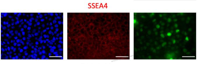 Anti-SSEA4 Antibody (MC813-70)