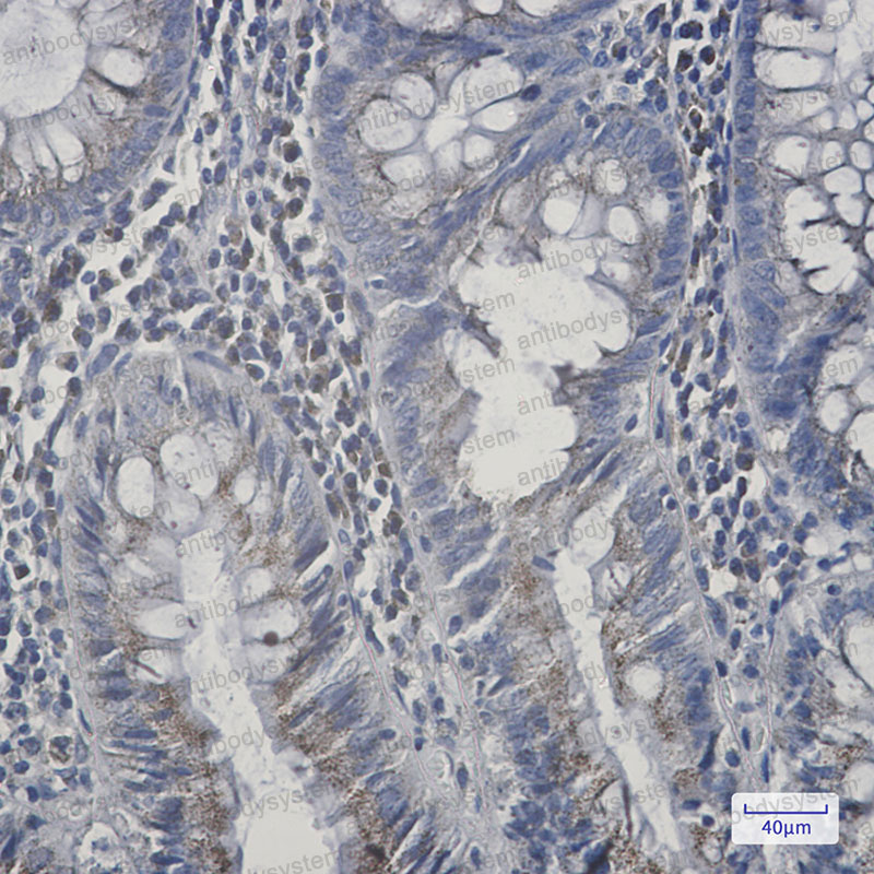 Anti-AGPS Antibody (R1C58)