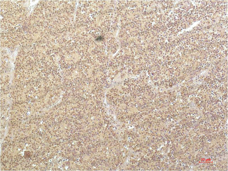 Immunohistochemical for Anti-SGK1 Antibody (R2T19) ?>