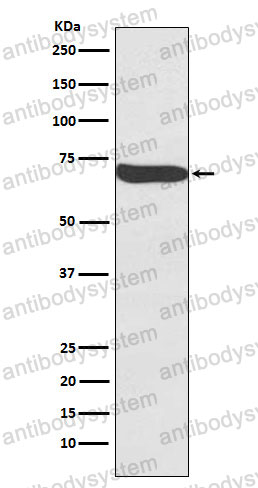 Anti-CD349/FZD9 Antibody (R1C60)