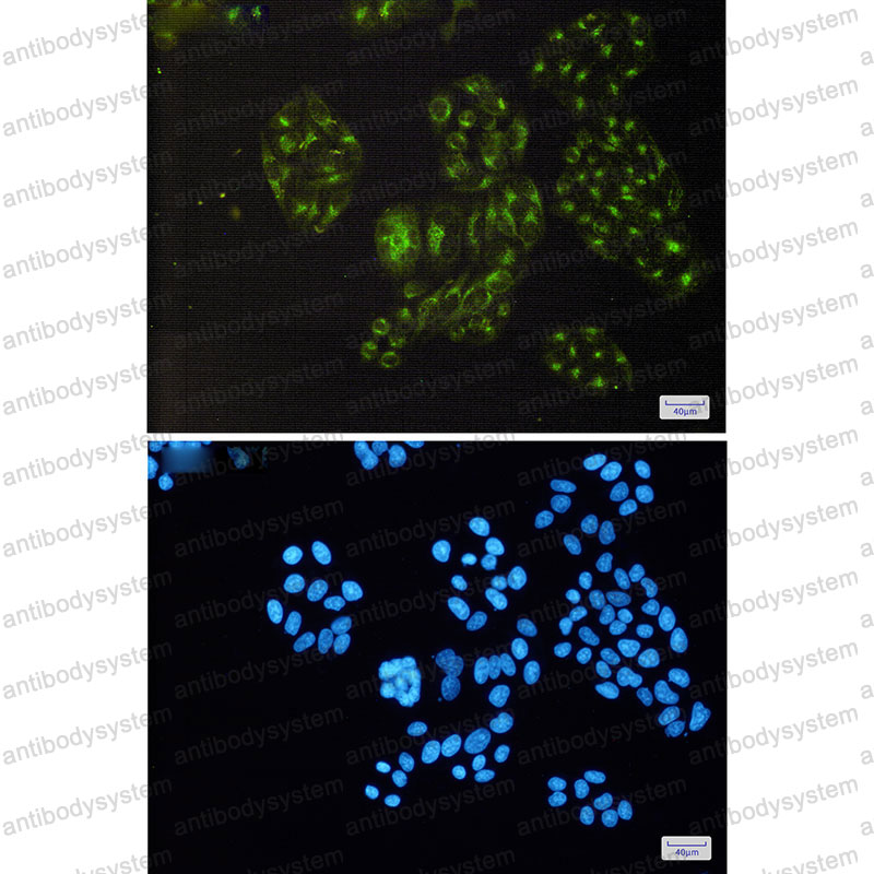 Anti-PDLIM1 Antibody (R1C63)