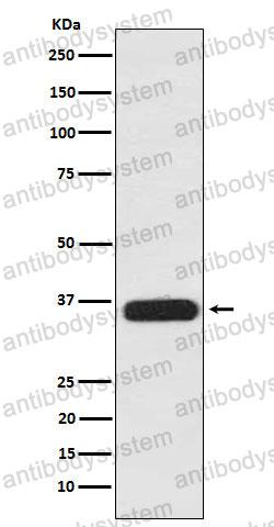 Anti-PDLIM1 Antibody (R1C62)