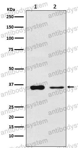 Anti-PDLIM1 Antibody (R1C61)