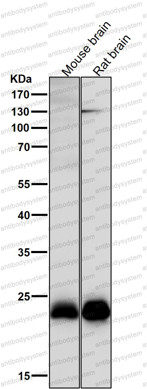 Anti-SNAP23 Antibody (R1C64)