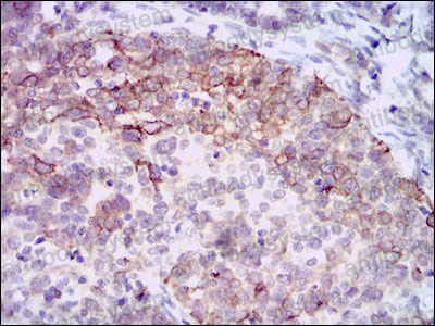 Immunohistochemical for Anti-HAS3 Antibody (R2T25) ?>