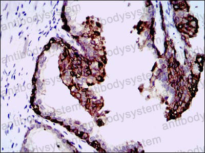Immunohistochemical for Anti-HAS3 Antibody (R2T25) ?>