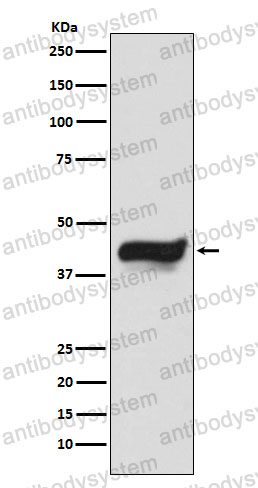 Anti-NFKBIE Antibody (R1C71)