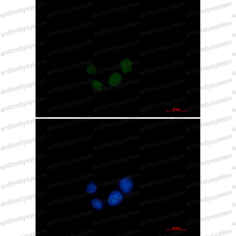 Anti-SUPT5H Antibody (R1C77)