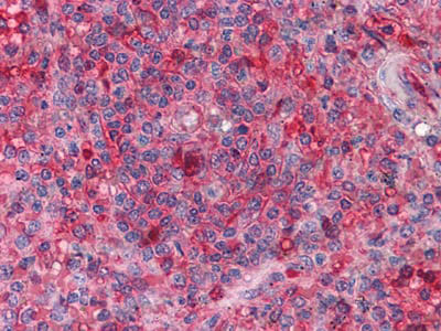 Anti-ARNTL Antibody (R2T40)