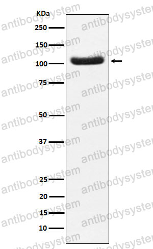 Anti-PDE2A Antibody (R1C87)