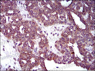 Immunohistochemical for Anti-DRP1/DNM1L Antibody (R2T47) ?>